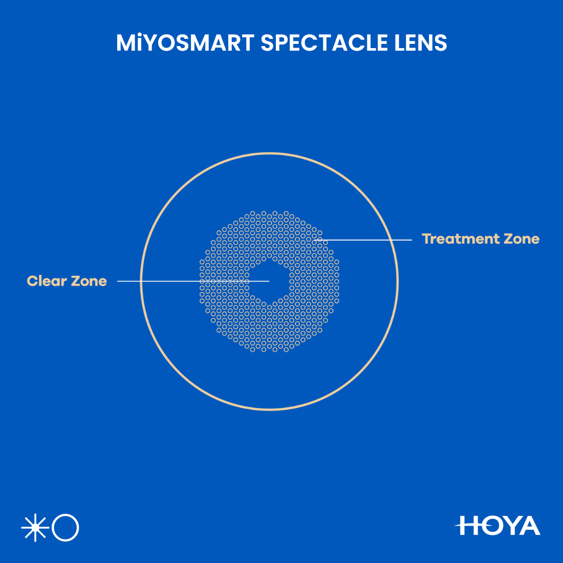 Shima Spectacle Lens MiYOSMART by Hoya for Myopia Management – Eye Connexion